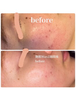 ヒメミ(Himemi)/大好評艶肌Wax☆