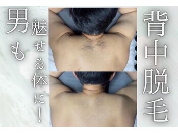 アルゴ 敦賀店(ALGO)/【メンズ背中脱毛】