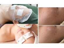 グロウスキン(GROW SKIN)/★肌育からはじめましょう