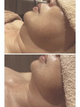 ペリドット(Peridot)/レモンボトル