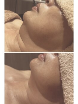 ペリドット(Peridot)/レモンボトル