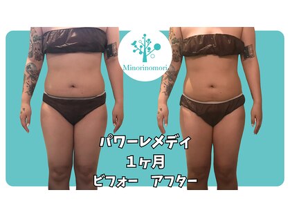 ミノリノモリ(Minorinomori)の写真