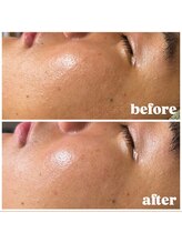 アンジール(ANJIR)/Men’s 