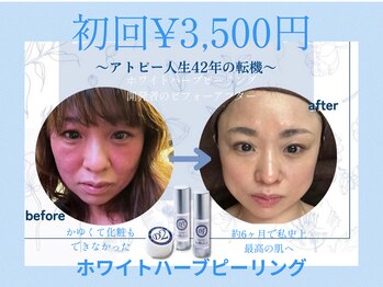 サロン エルピナ(salon ELPINA)