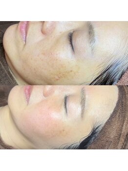 ホワラ 横浜店(Whila)/施術効果8