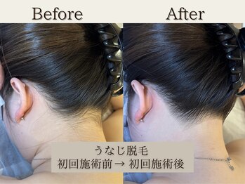 インベスト(INVEST)/うなじ☆