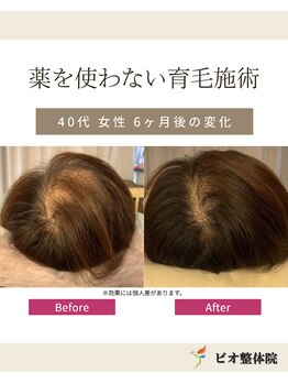コレア整体院(COREA整体院)/ 再生育毛促進術
