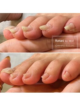 ユマニ バイ ヒート(Humani by HEAT)/自分では切れない爪の爪切り
