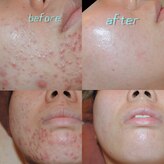 ビューティーサロンレモン(Lemon)