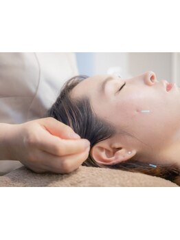 小顔になりたい