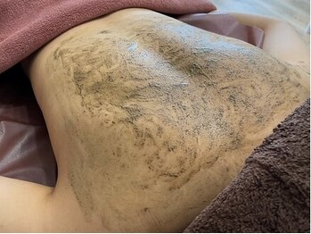 ドクターエピ(Dr.Epi)/メンズ背中ハーブピーリング☆