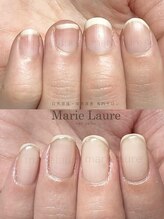 マリーロール 梅田店(Marie Laure)/深爪矯正/自爪育成/ネイルケア
