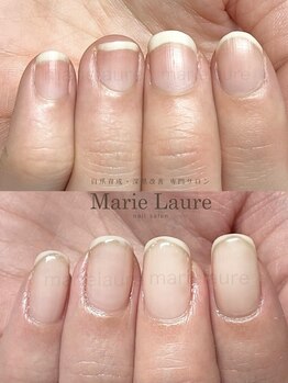 マリーロール 梅田店(Marie Laure)/深爪矯正/自爪育成/ネイルケア
