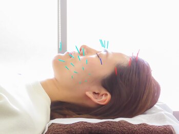 あいあい整骨院 津山院/美容鍼　肌質改善・リフトアップ