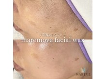 ファンデいらずのお肌へ、マリムーブフェイシャルワックス
