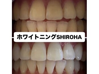 シロハ(SHIROHA)/セルフホワイトニング/天王寺
