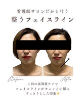 エフリア 大垣(F.lia)/ぼやけたフェイスラインがキュッ