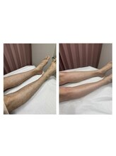 モアラニ(Moalani)/Before→After