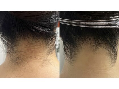 リュール(Lueur)の写真