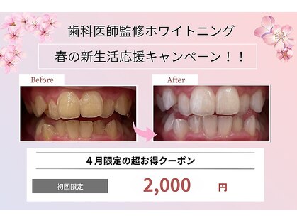 ホワイトニングショップ 三田店の写真