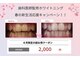 ホワイトニングショップ 三田店の写真