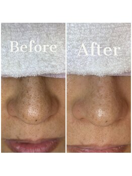 ウエカ(ueka)/くすみのないクリアな肌へ