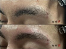 眉毛男子 新宿店/眉毛 　before / after