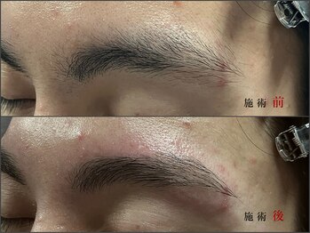 眉毛男子 新宿店/眉毛 　before / after