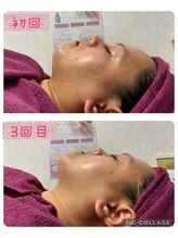 ビューティーサロン キャンディ 海老名(Candy)/