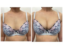 リボミュウ(Ribbomiu)の雰囲気（コース10回目の産後40代お客様/最後のバストケアにしませんか？）