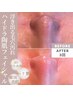 【3回分】お得に継続★韓国で人気の3D毛穴洗浄!陶肌フェイシャル60分/59400→