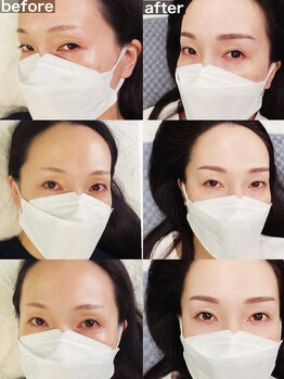 美ラボ リッチエンジェル/ノーメイクでも綺麗が続く！