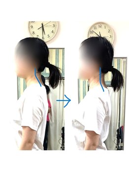 エスコート芦屋サロン/首が前に出る　スマホ首