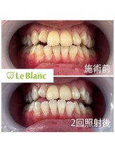 ルブラン 奈良店(Le Blanc)/まずはお試しクーポンで♪