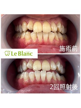 ルブラン 奈良店(Le Blanc)/まずはお試しクーポンで♪