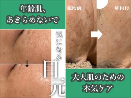 ヴィヴフォー(VIV for)の写真