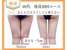 リュミエール(Lumiere)の雰囲気（40代☆部分集中ダイエット！太もものセルライト撃退！）