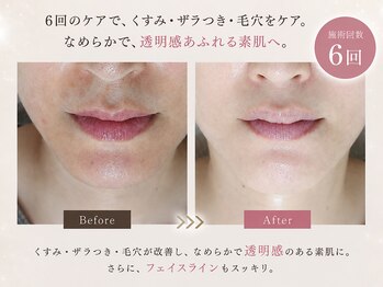 オレオマ(OLEOMA)の写真/『何を選べばいいのか分からない』そんな方はコレ!