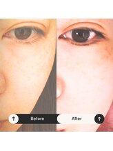 ゆう/ビフォーアフター