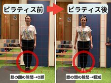 ファクト(fact)/XO脚、太ももの張りがお悩み