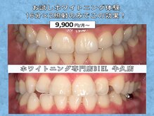 ビエル 牛久店(BIEL)/お試しホワイトニング