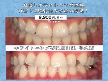 ビエル 牛久店(BIEL)/お試しホワイトニング