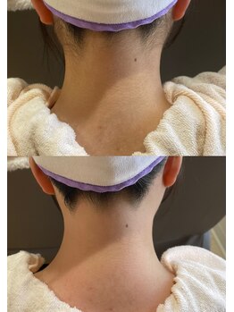 ファミーユ 太田(Fameu)/襟足wax