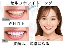 ホワイトニングサロン ホワイト 前橋店(WHITE)