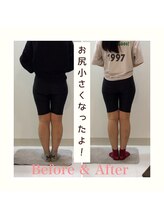 スタイルラボ高松/骨盤矯正の効果♪