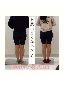 スタイルラボ高松/骨盤矯正の効果♪