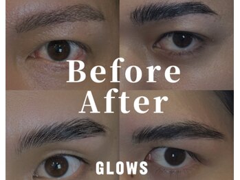 グロース 福岡天神店(GLOWS)/メンズ眉毛《眉毛/天神/赤坂》