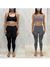 ルビア 岡崎矢作店(LUVIA)/Before&After