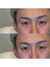 [KOYUKI限定]メンズ眉毛【骨格似合やせオーダーデザイン】 ¥7700→¥5500