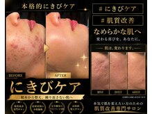 ミライ(Mirai)/凸凹肌◎オーダーメイドハーブ